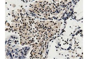 Immunohistochemical staining of paraffin-embedded Human colon tissue using anti-BTN1A1 mouse monoclonal antibody. (BTN1A1 anticorps)