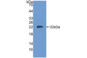 Figure. (PTPRN anticorps  (AA 35-185))