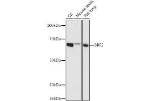Western blot analysis of extracts of various cell lines, using BRF2 antibody (ABIN6129998, ABIN6137657, ABIN6137658 and ABIN6224790) at 1:1000 dilution. (BRF2 anticorps  (AA 1-120))