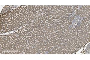 IHC analysis of SHMT1 using anti-SHMT1 antibody (ABIN7599420). (SHMT1 anticorps  (AA 1-470))