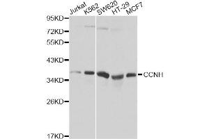 Western blot analysis of extracts of various cell lines, using CCNH Antibody (ABIN5970383). (Cyclin H anticorps)