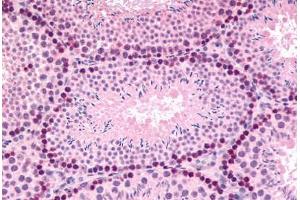 Mouse, Testis (formalin-fixed, paraffin-embedded) stained with GLI2 antibody ABIN214612 at 5 ug/ml followed by biotinylated goat anti-rabbit IgG secondary antibody ABIN481713, alkaline phosphatase-streptavidin and chromogen. (GLI2 anticorps  (Internal Region))