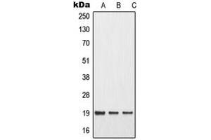 Western blot analysis of MMP1 22k expression in MCF7 UV-treated (A), mouse liver (B), rat liver (C) whole cell lysates. (MMP1 22k anticorps  (Center))
