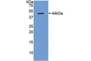 Detection of Recombinant Gastrin, Rat using Polyclonal Antibody to Gastrin (GT) (Gastrin anticorps  (AA 1-104))