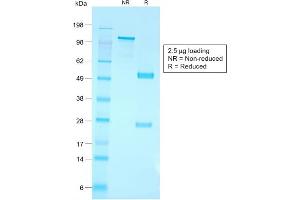SDS-PAGE Analysis Purified CD79a Rabbit Recombinant Monoclonal Antibody (IGA/1790R).