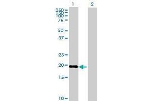 Lane 1: TIMM22 transfected lysate ( 20 KDa) Lane 2: Non-transfected lysate. (TIMM22 293T Cell Transient Overexpression Lysate(Denatured))