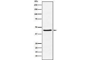 Western blot analysis of HSD3B1 expression in Human placenta lysate.