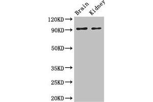 Western Blot Positive WB detected in: Mouse brain tissue, Mouse kidney tissue All lanes: SLC9A1 antibody at 3 μg/mL Secondary Goat polyclonal to rabbit IgG at 1/50000 dilution Predicted band size: 91, 62 kDa Observed band size: 91 kDa (SLC9A1 anticorps  (AA 36-102))