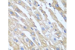 Immunohistochemistry of paraffin-embedded Human liver using PPP4R1 Polyclonal Antibody at dilution of 1:100 (40x lens). (PPP4R1 anticorps)