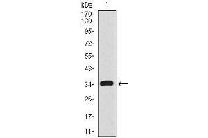 Western blot analysis using CD59 mAb against human CD59 recombinant protein. (CD59 anticorps  (AA 31-111))
