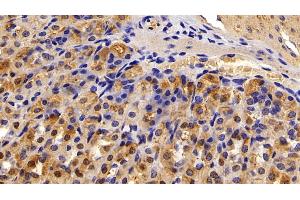 Detection of ALT in Mouse Stomach Tissue using Polyclonal Antibody to Alanine Aminotransferase (ALT)