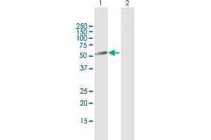 Western Blot analysis of PLB1 expression in transfected 293T cell line by PLB1 MaxPab polyclonal antibody. (Phospholipase B anticorps  (AA 1-488))