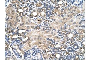 HFE antibody was used for immunohistochemistry at a concentration of 4-8 ug/ml to stain Epithelial cells of renal tubule (arrows) in Human Kidney. (HFE anticorps  (C-Term))