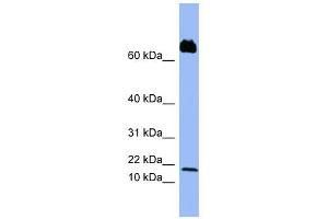 PF4V1 antibody used at 1 ug/ml to detect target protein. (PF4V1 anticorps  (Middle Region))