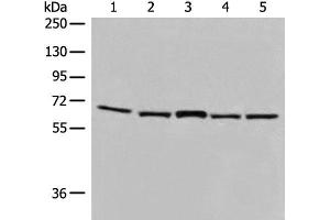 Western blot analysis of TM4 and 231 cell Mouse brain tissue Hela and HT-29 cell lysates using EHD1 Polyclonal Antibody at dilution of 1:500 (EHD1 anticorps)