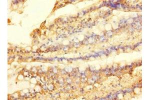 Immunohistochemistry of paraffin-embedded human small intestine tissue using ABIN7170032 at dilution of 1:100 (SLC28A1 anticorps  (AA 1-80))