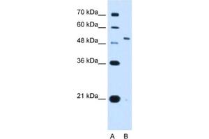Western Blotting (WB) image for anti-Potassium Voltage-Gated Channel, Shaw-Related Subfamily, Member 1 (KCNC1) antibody (ABIN2462986) (KCNC1 anticorps)