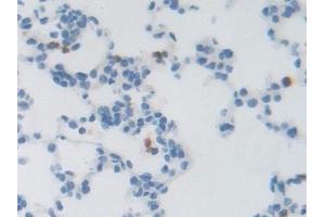 Detection of LRRC32 in Rat Lung Tissue using Polyclonal Antibody to Leucine Rich Repeat Containing Protein 32 (LRRC32) (LRRC32 anticorps  (AA 162-405))