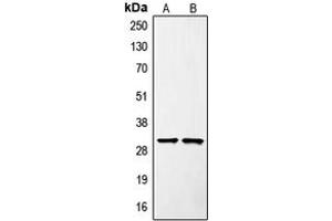 Western blot analysis of SURF1 expression in Jurkat (A), mouse liver (B) whole cell lysates. (SURF1 anticorps  (Center))