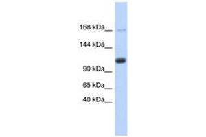 Image no. 1 for anti-U2-Associated SR140 Protein (SR140) (AA 755-804) antibody (ABIN6740720) (SR140 anticorps  (AA 755-804))