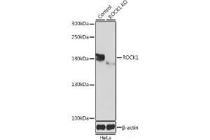Western blot analysis of extracts from normal (control) and ROCK1 knockout (KO) HeLa cells using ROCK1 Polyclonal Antibody at dilution of 1:1000. (ROCK1 anticorps)