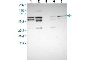 Western blot analysis of Lane 1: RT-4, Lane 2: U-251 MG, Lane 3: Human Plasma, Lane 4: Liver, Lane 5: Tonsil with C14orf133 polyclonal antibody . (VIPAR anticorps)