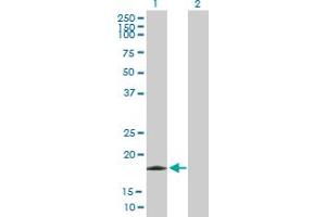Western Blot analysis of EIF5A2 expression in transfected 293T cell line by EIF5A2 MaxPab polyclonal antibody. (EIF5A2 anticorps  (AA 1-153))