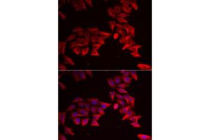 Immunofluorescence analysis of HeLa cells using SFRP4 antibody.