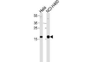 Western blot analysis of NDP kinase A Antibody (C-term) Cat. (NME1 anticorps  (C-Term))