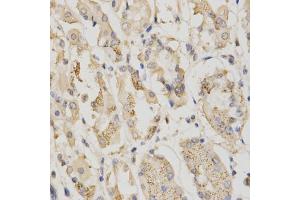 Immunohistochemistry of paraffin-embedded human stomach using STK11 antibody (ABIN5971149) at dilution of 1/200 (40x lens). (LKB1 anticorps)