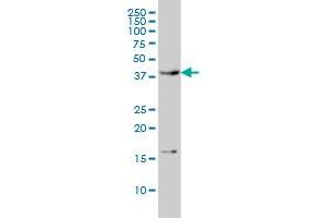 CAMK1 monoclonal antibody (M01), clone 3G1 Western Blot analysis of CAMK1 expression in HL-60 . (CAMK1 anticorps  (AA 271-370))