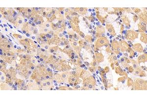 Detection of AMPK Alpha 1 in Human Stomach Tissue using Polyclonal Antibody to Protein Kinase, AMP Activated Alpha 1 (AMPK Alpha 1)