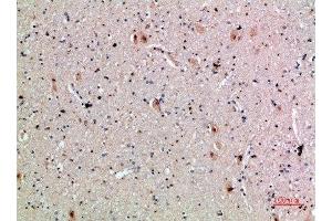 Immunohistochemical analysis of paraffin-embedded human-brain, antibody was diluted at 1:200