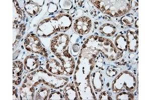 Immunohistochemical staining of paraffin-embedded Kidney tissue using anti-NPR3 mouse monoclonal antibody. (NPR3 anticorps)