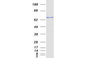 Validation with Western Blot