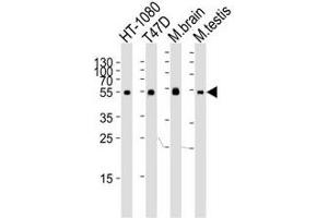 Western blot analysis of lysate from HT-1080, T47D cell line, mouse brain and testis tissue lysate using TUBA6 antibody at 1:1000. (TUBA1C anticorps  (N-Term))