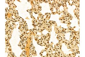ABIN7094285 and ABIN7098332 at 1/100 staining Rat lung tissue by IHC-P. (HP1BP3 anticorps  (Internal Region))