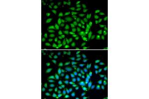 Immunofluorescence analysis of U2OS cells using MECP2 antibody (ABIN6134134, ABIN6143680, ABIN6143682 and ABIN6217279).