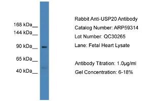 WB Suggested Anti-USP20  Antibody Titration: 0. (USP20 anticorps  (Middle Region))