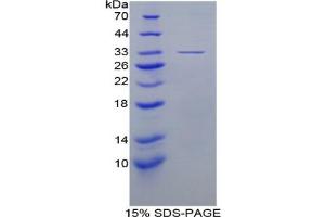 SDS-PAGE analysis of Mouse EIF3A Protein. (EIF6 Protéine)