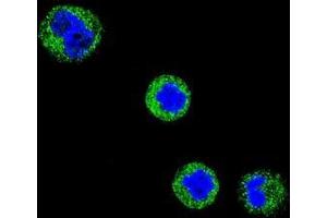 Confocal immunofluorescent analysis of CD1E Antibody (Center)(Cat#AP50840PU-N) with MDA-MB435 cell followed by Alexa Fluor 488-conjugated goat anti-rabbit lgG (green).