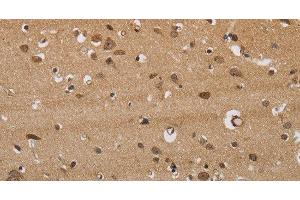 Immunohistochemistry of paraffin-embedded Human brain tissue using ITPR3 Polyclonal Antibody at dilution 1:40