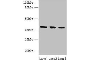 Western blot All lanes: GALE antibody at 2 μg/mL Lane 1: HepG2 whole cell lysate Lane 2: Hela whole cell lysate Lane 3: A549 whole cell lysate Secondary Goat polyclonal to rabbit IgG at 1/10000 dilution Predicted band size: 39, 31 kDa Observed band size: 39 kDa (GALE anticorps  (AA 1-348))
