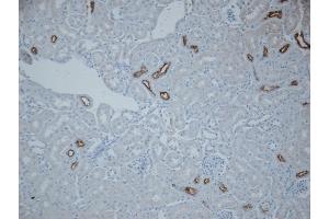 Immunohistochemistry analysis using Rabbit Anti-NCC Polyclonal Antibody (ABIN2486282).