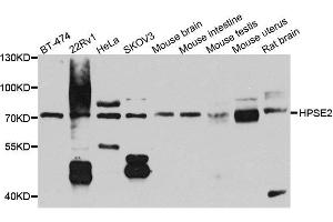 Western blot analysis of extracts of various cell lines, using HPSE2 antibody. (Heparanase 2 anticorps  (AA 42-242))