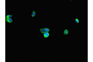 Immunofluorescent analysis of HepG2 cells using ABIN7151194 at dilution of 1:100 and Alexa Fluor 488-congugated AffiniPure Goat Anti-Rabbit IgG(H+L) (RNF4 anticorps  (AA 1-103))