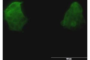 Immunofluorescence of monoclonal antibody to TSPAN8 on 293 cell. (Tspan-8 anticorps  (AA 110-205))