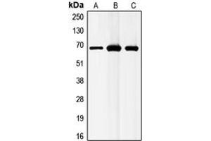 Western blot analysis of GABRB1 expression in MCF7 (A), mouse liver (B), rat liver (C) whole cell lysates. (GABRB1 anticorps  (C-Term))