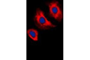Immunofluorescent analysis of VEGFR2 (pY1175) staining in MCF7 cells. (VEGFR2/CD309 anticorps  (C-Term, pTyr1175))