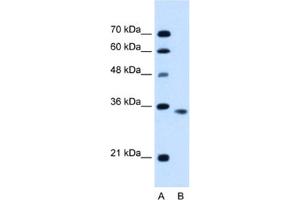 Western Blotting (WB) image for anti-Activin A Receptor, Type IIB (ACVR2B) antibody (ABIN2462828) (ACVR2B anticorps)